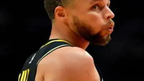 佩雷拉左臂骨折，坚持带队比赛采用保守疗法治疗